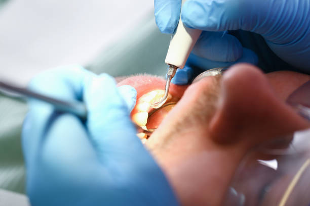 Best Broken Tooth Emergency  in Eldon, MO